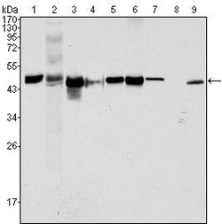 Invitrogen Cytokeratin 18 Monoclonal Antibody (4D11E4) 100 &mu;L; Unconjugated:Antibodies,