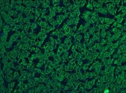 Invitrogen Cytokeratin 5/8 Monoclonal Antibody (RCK102) 100 &mu;L; Unconjugated:Antibodies,