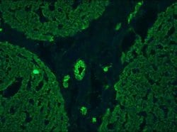 Invitrogen Cytokeratin 5/8 Monoclonal Antibody (RCK102) 100 &mu;L; Unconjugated:Antibodies,