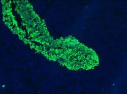 Invitrogen Cytokeratin 5/8 Monoclonal Antibody (RCK102) 100 &mu;L; Unconjugated:Antibodies,