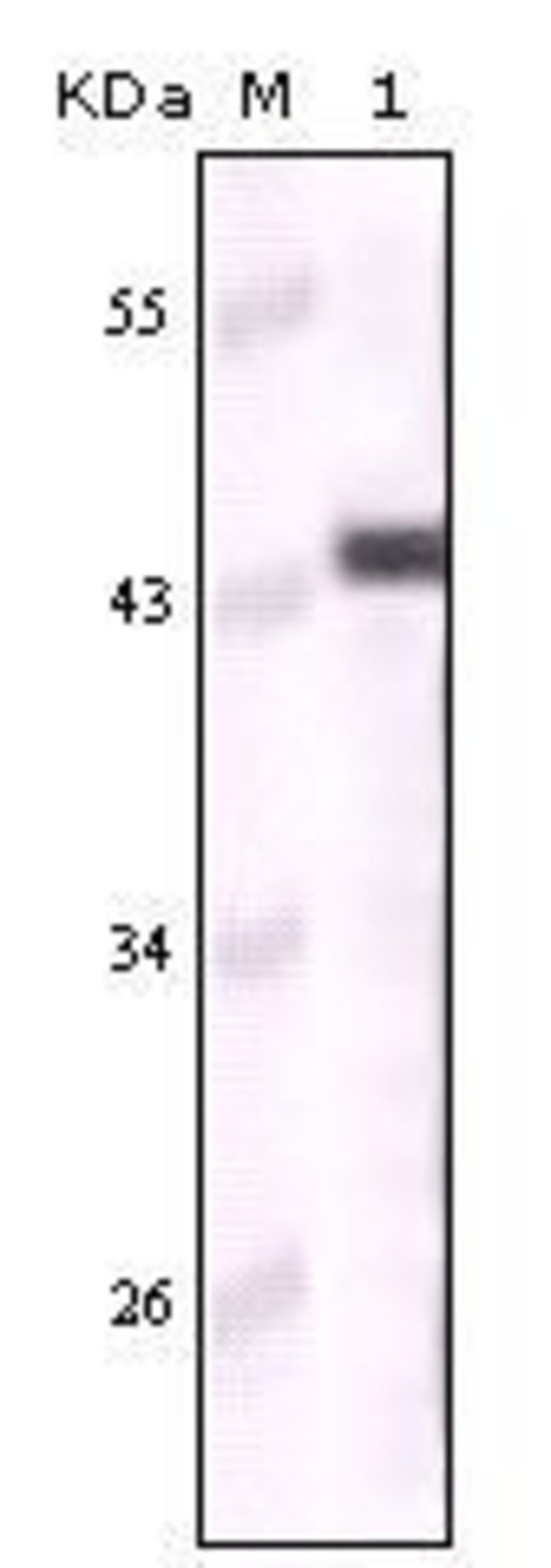 Cytokeratin 5 Monoclonal Antibody (3E2F1), Invitrogen™ 100 μL