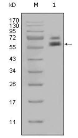 Invitrogen Cytokeratin 5 Monoclonal Antibody (1E1) 100 &mu;L; Unconjugated:Antibodies,
