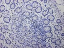 Invitrogen Cytokeratin 7 Monoclonal Antibody (OVTL12/30) 100 &mu;L; Unconjugated:Antibodies,
