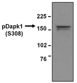 Invitrogen Phospho-DAPK1 (Ser308) Monoclonal Antibody (DKPS308) 50 &mu;L;