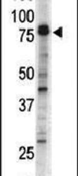 DCLK1 Rabbit anti-Human, Mouse, Polyclonal, Invitrogen 400 &mu;L; Unconjugated:Antibodies,