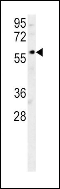 DCLRE1B Rabbit anti-Human, Mouse, Polyclonal, Invitrogen 400 &mu;L; Unconjugated:Antibodies,