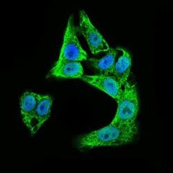 Invitrogen Doublecortin Monoclonal Antibody (2G5) 100 &mu;g; Unconjugated:Antibodies,
