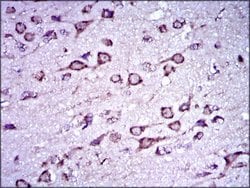 Invitrogen Doublecortin Monoclonal Antibody (2G5) 100 &mu;g; Unconjugated:Antibodies,