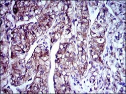 Invitrogen Doublecortin Monoclonal Antibody (2G5) 100 &mu;g; Unconjugated:Antibodies,