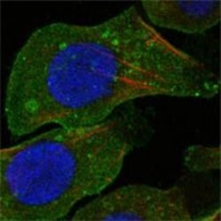 Invitrogen DDR2 Monoclonal Antibody (3B11E4) 100 &mu;L; Unconjugated:Antibodies,