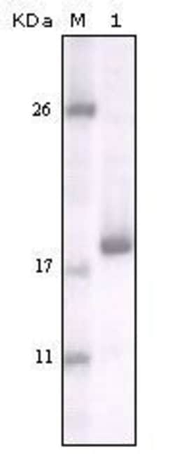 Invitrogen DDR2 Monoclonal Antibody (3B11E4) 100 &mu;L; Unconjugated:Antibodies,