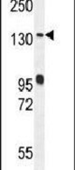 DENND5A Rabbit anti-Human, Polyclonal, Invitrogen 400 μL; Unconjugated:Antibodies,