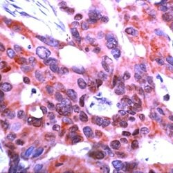 ICAD Rabbit anti-Human, Polyclonal, Invitrogen 1 mL | Buy Online | Invitrogen | Fisher Scientific