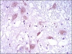 Invitrogen DKK3 Monoclonal Antibody (8A5C6) 100 &mu;g; Unconjugated:Antibodies,