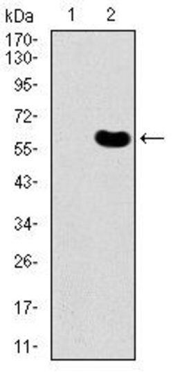 Invitrogen DKK3 Monoclonal Antibody (8A5C6) 100 &mu;g; Unconjugated:Antibodies,