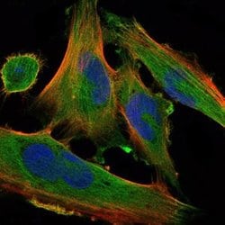 Invitrogen DLK1 Monoclonal Antibody (3A10) 100 &mu;L; Unconjugated:Antibodies,