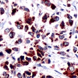 DOK2 Rabbit anti-Human, Polyclonal, Invitrogen 500 μL; Unconjugated:Antibodies,