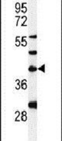 DPAGT1 Rabbit anti-Human, Polyclonal, Invitrogen 400 μL; Unconjugated:Antibodies,