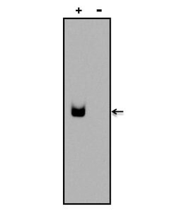 Invitrogen Digoxin Monoclonal Antibody (26G10) 100 &mu;g; Unconjugated:Antibodies,