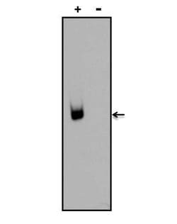 Invitrogen Digoxin Monoclonal Antibody (38G12) 1 mg; Unconjugated:Antibodies,