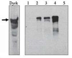 Invitrogen DYRK1A Polyclonal Antibody 100 &mu;g; Unconjugated:Antibodies,