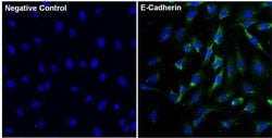 Invitrogen E-cadherin Recombinant Superclonal Antibody (5HCLC) 100 &mu;g;