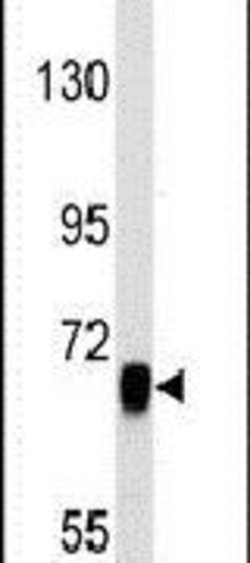 EGFR Rabbit anti-Human, Polyclonal, Invitrogen 400 &mu;L; Unconjugated:Antibodies,