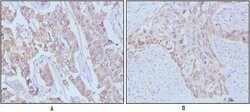 Invitrogen EGF Monoclonal Antibody (9D7F11) 100 &mu;L; Unconjugated:Antibodies,