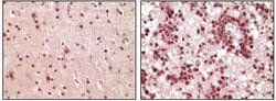 Invitrogen ELK1 Monoclonal Antibody (3H6D12, 4H9C8, 4H9F1) 100 &mu;L; Unconjugated:Antibodies,