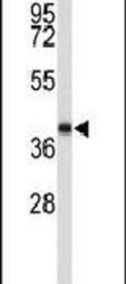 EN2 Polyclonal Antibody, Invitrogen 400 &mu;L; Unconjugated:Antibodies,
