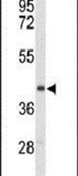 ENTPD2 Rabbit anti-Human, Polyclonal, Invitrogen 400 &mu;L; Unconjugated:Antibodies,