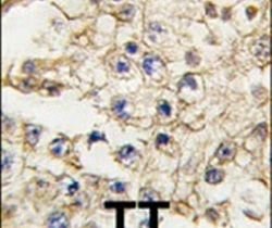 EphA10 Rabbit anti-Human, Polyclonal, Invitrogen 400 &mu;L; Unconjugated:Antibodies,