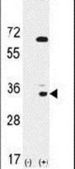 EphA10 Rabbit anti-Human, Polyclonal, Invitrogen 400 &mu;L; Unconjugated:Antibodies,