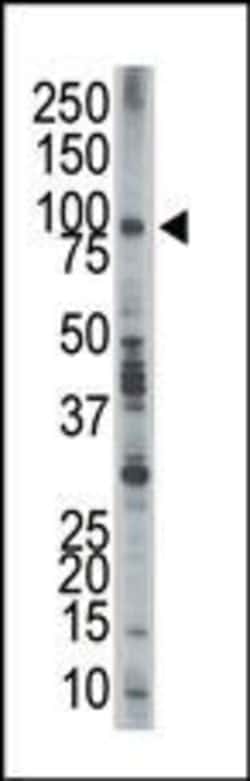 EPS8 Rabbit anti-Human, Polyclonal, Invitrogen 400 &mu;L; Unconjugated:Antibodies,
