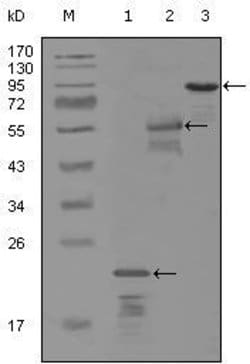 Invitrogen ErbB3 Monoclonal Antibody (2B11D11) 100 &mu;L; Unconjugated:Antibodies,