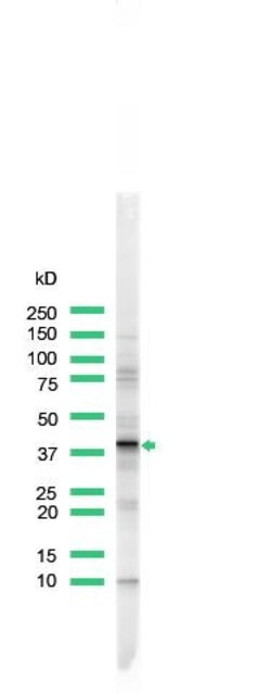 ERCC1 Rabbit anti-Human, Polyclonal, Invitrogen 500 &mu;L; Unconjugated:Antibodies,