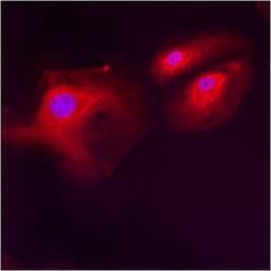 Invitrogen LMAN1 Polyclonal Antibody 100 &mu;g; Unconjugated:Antibodies,