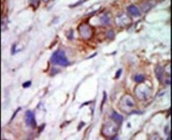 ERK5 Polyclonal Antibody, Invitrogen 400 &mu;L; Unconjugated:Antibodies,