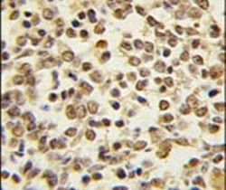 ERK5 Polyclonal Antibody, Invitrogen 400 &mu;L; Unconjugated:Antibodies,