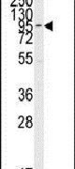 ERK5 Polyclonal Antibody, Invitrogen 400 &mu;L; Unconjugated:Antibodies,