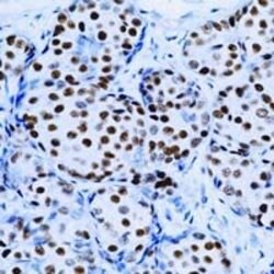 Invitrogen Estrogen Receptor alpha Monoclonal Antibody (SP1) 1 mL; Unconjugated:Antibodies,