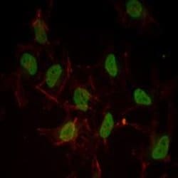 Invitrogen Estrogen Receptor alpha Monoclonal Antibody (6B6) 100 &mu;L;