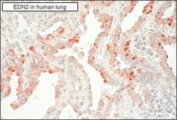 Invitrogen&trade;&nbsp;Endothelin 2 Polyclonal Antibody