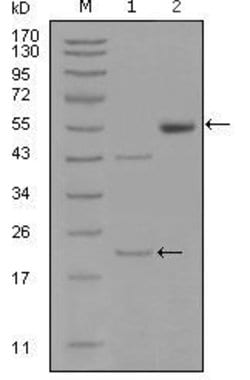 Invitrogen EphA5 Monoclonal Antibody (8B10B1,8B10F5) 100 &mu;L; Unconjugated:Antibodies,