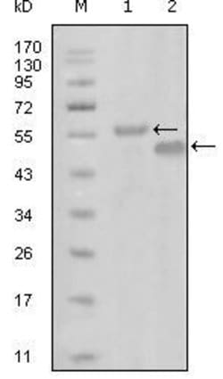 Invitrogen EphA6 Monoclonal Antibody (3D5B10) 100 &mu;L; Unconjugated:Antibodies,
