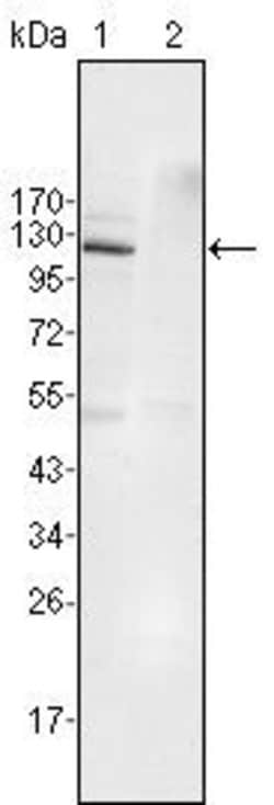 Invitrogen EphB4 Monoclonal Antibody (7H4A6) 100 &mu;L; Unconjugated:Anticuerpos