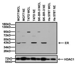 Estrogen Receptor alpha Polyclonal Antibody, Invitrogen 500 &mu;L; Unconjugated:Antibodies,