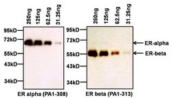 Invitrogen Estrogen Receptor alpha Polyclonal Antibody 50 &mu;g; Unconjugated:Antibodies,