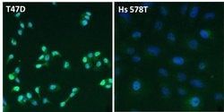 Invitrogen Estrogen Receptor alpha Polyclonal Antibody 50 &mu;g; Unconjugated:Antibodies,