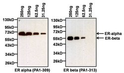 Invitrogen Estrogen Receptor alpha Polyclonal Antibody 50 &mu;g; Unconjugated:Antibodies,